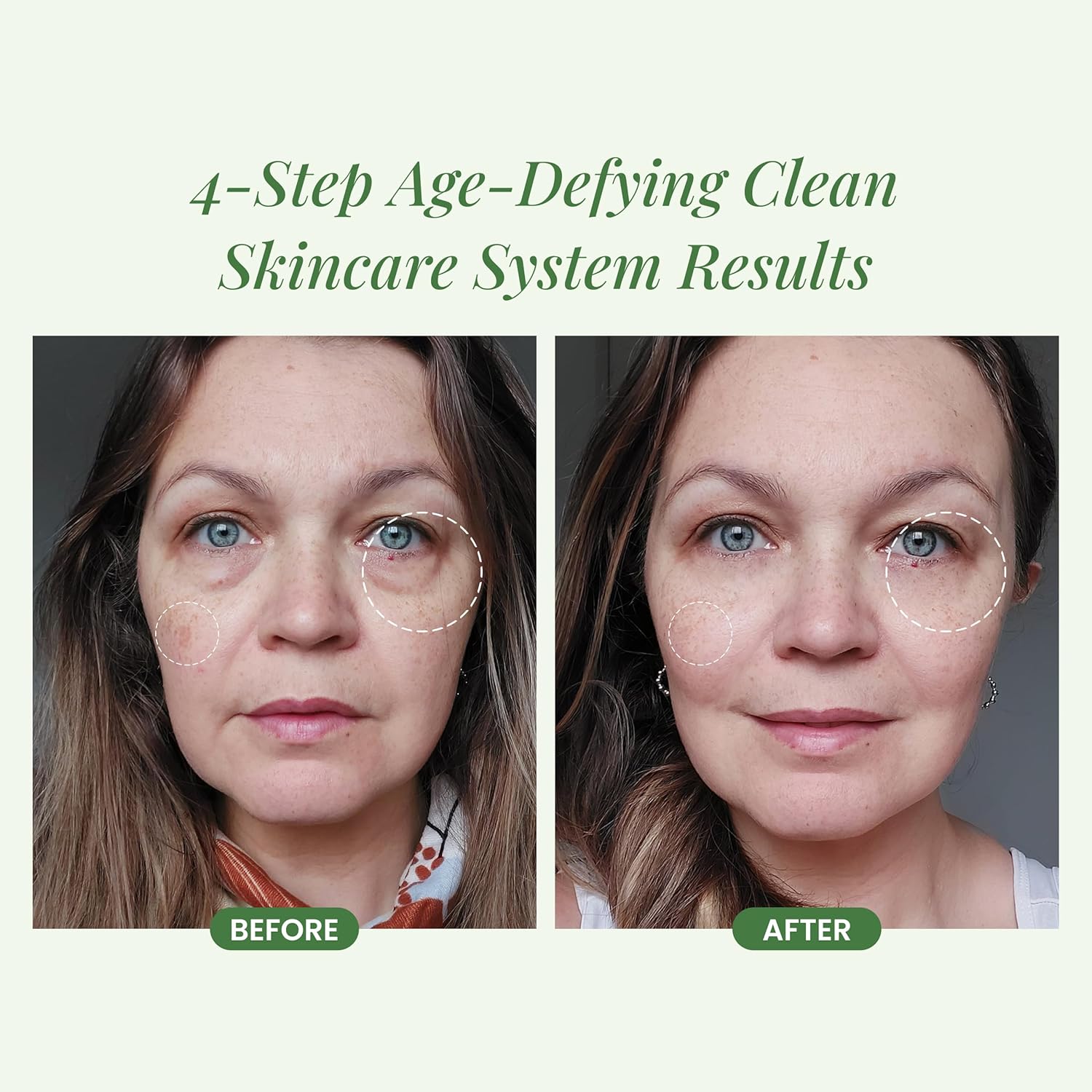 4-Step Skin Care Kit U692943